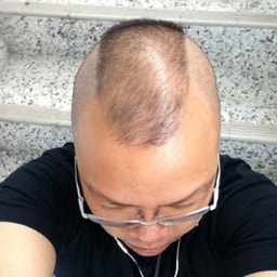profile